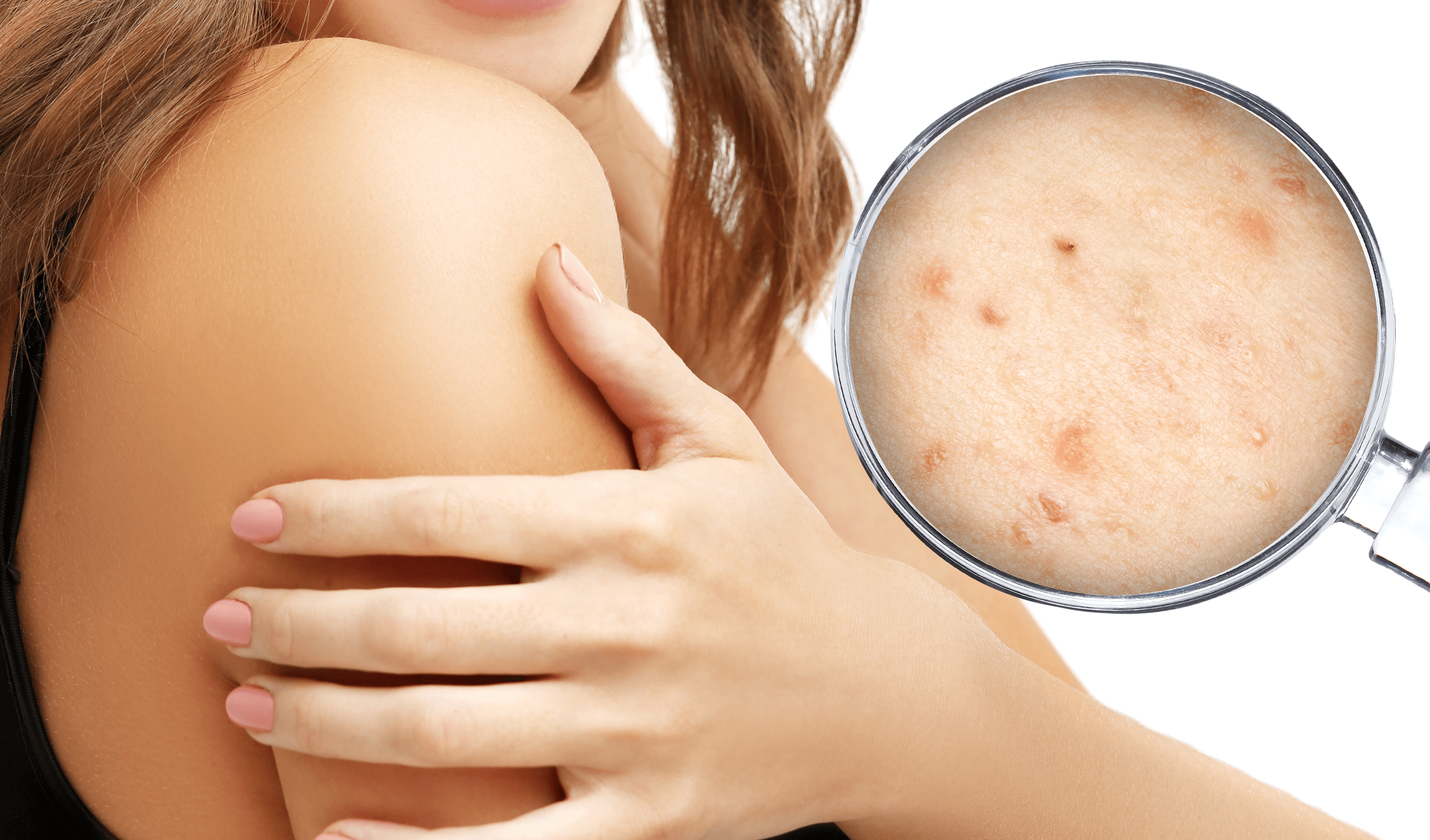 Dermatology